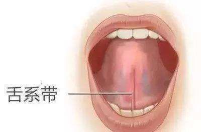 『发音』剪还是不剪？捏积派——孩子话讲不清楚可能与舌系带短有关