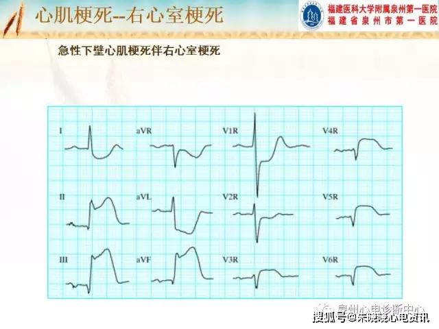 10fff71ff7894dce8c3846deb97a48fe.JPG
