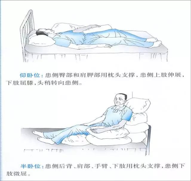 患者回归家庭之后,可以从以下几个方面来进行肩关节及上肢,手功能康复