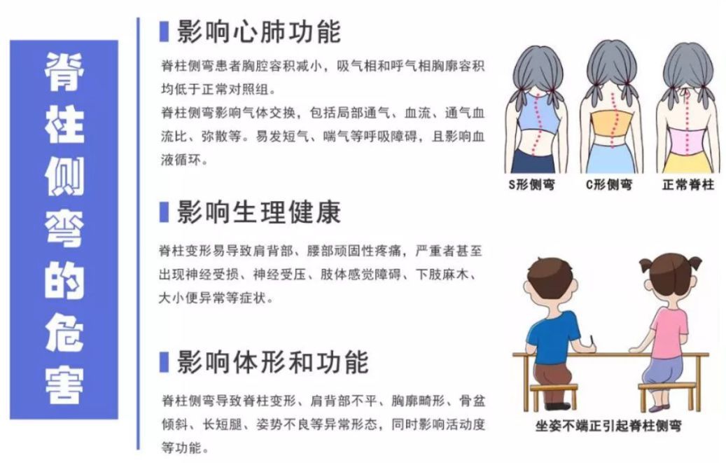 如何预防青少年脊柱侧弯?