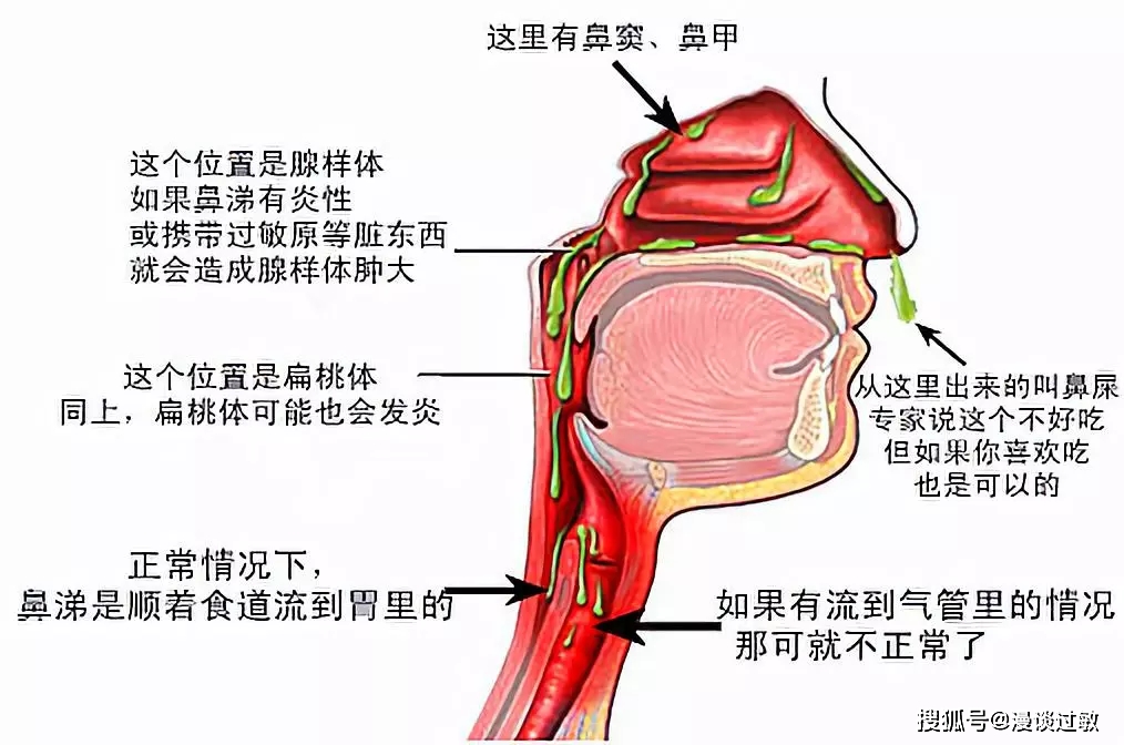 咳嗽变异性哮喘、过敏性哮喘？它们与鼻炎、鼻后滴漏症、腺样体有什么关系？