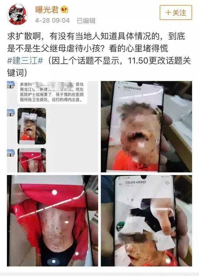 原创4岁女童长期遭禽兽继母非人虐待，重伤后ICU仍在抢救，央视新闻愤怒发声