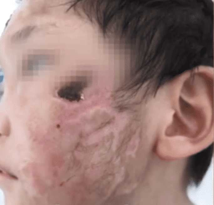 原创4岁女童长期遭禽兽继母非人虐待，重伤后ICU仍在抢救，央视新闻愤怒发声