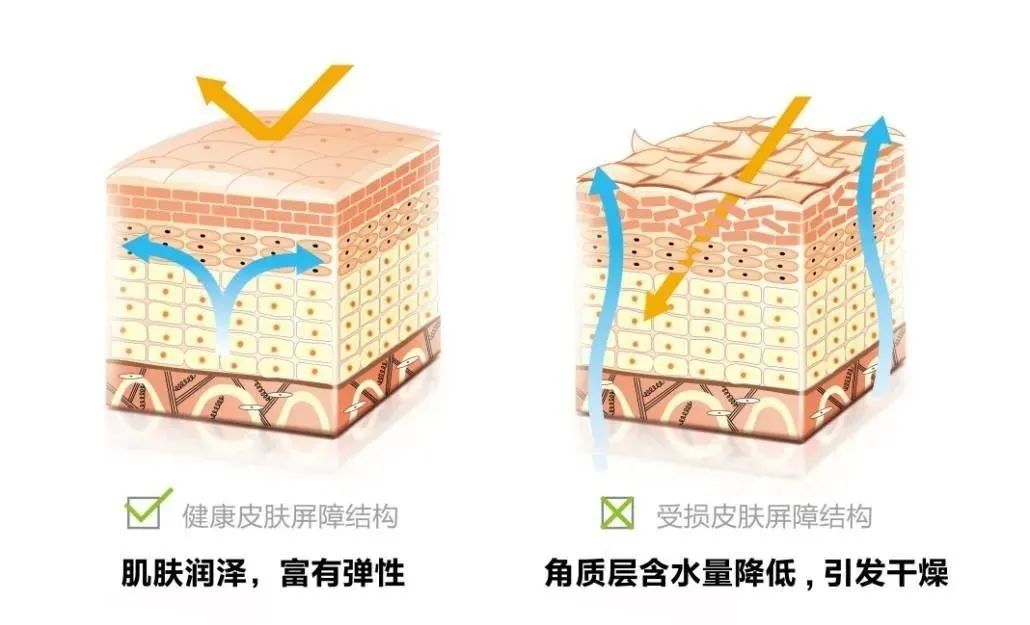 护理|宝宝身上的湿疹和痱子分清了吗？夏天已到