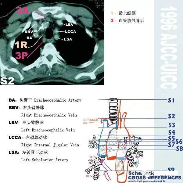 今日分享 — 纵隔淋巴结分区图谱