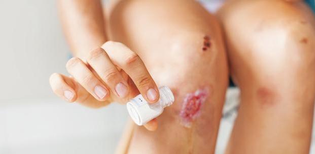 孩子|家长可不能放任孩子小孩更容易发生长白癜风?这3件事