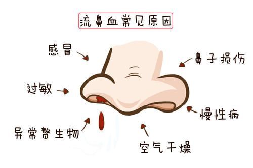 孩子|捏积派——宝宝为什么流鼻血?附小儿推拿及家庭处理方法