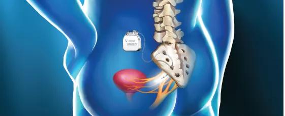 以此兴奋或抑制神经桐庐,调节异常骶神经反射弧,进而影响并调节膀胱