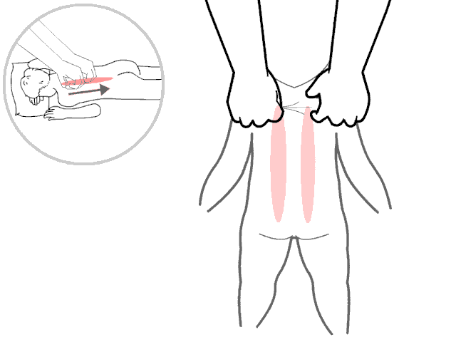 孩子|宝宝少生病！如何正确给宝宝捏脊？捏积派——妈妈会捏脊