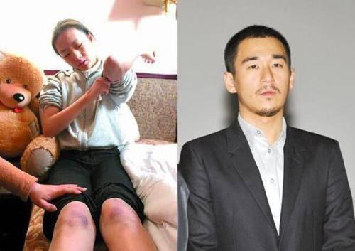 和老师传绯闻、被张国立儿子殴打，17年后，童谣