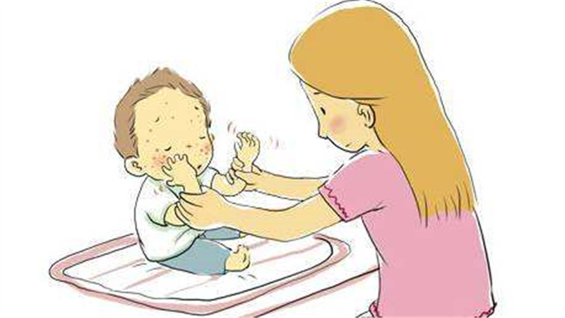 在夏季宝宝的湿疹需要怎样护理？