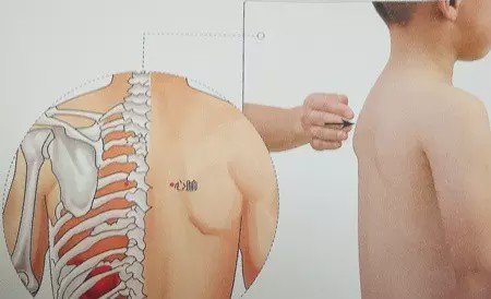 小儿|捏积派——孩子受到惊吓、哭闹不安?小儿推拿帮宝宝镇惊安神!