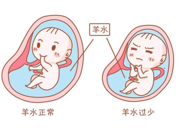原创当羊水过少,胎儿要如何安全待在子宫里?