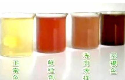 身体极其缺水,并且夜间基本也不排尿,尿液的颜色会加深是正常的表现
