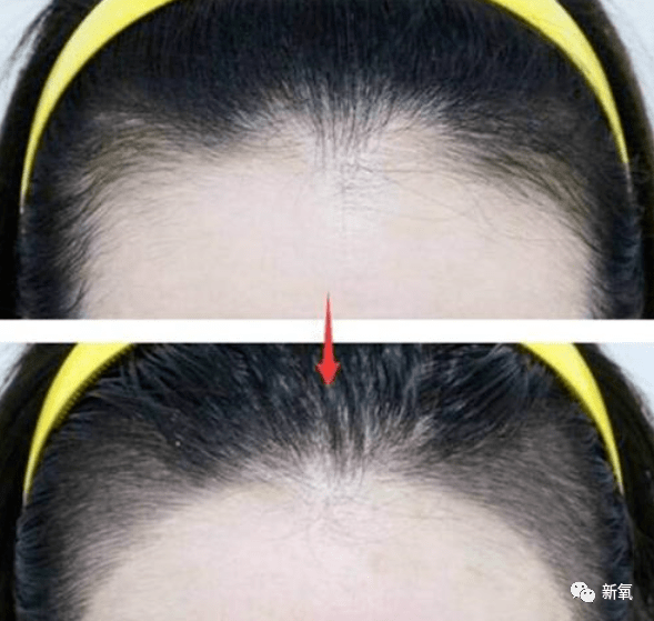 虞书欣不是才24岁吗?怎么就秃成这样了…