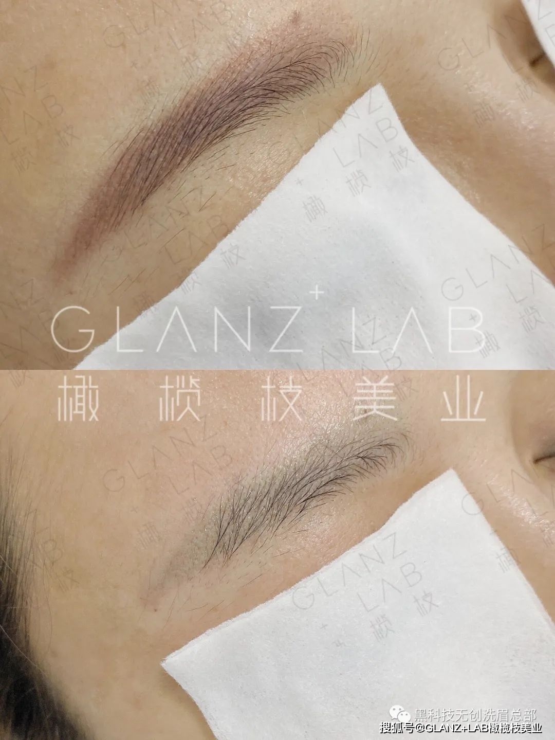全城搜索失败眉:红眉,蓝眉,花眉,橄榄枝美业无创洗眉技术为你服务!