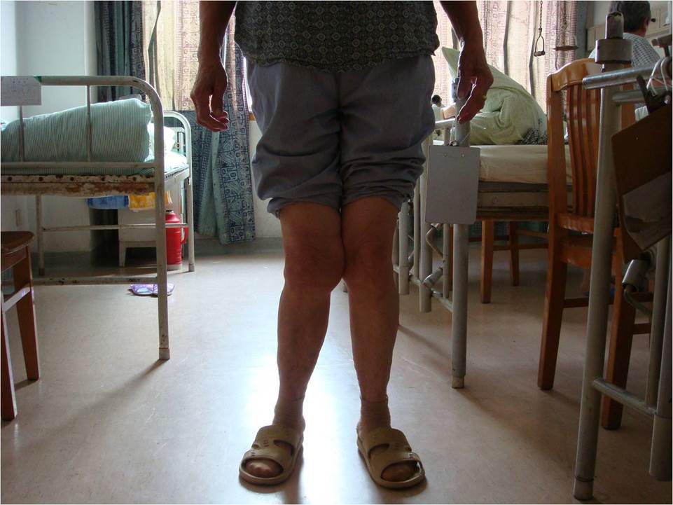 孩子|长大后变丑”并非铁定律，避开这些原因即可“孩子小时候可爱
