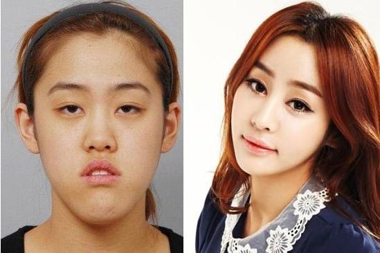 爸妈的颜值高却生出丑娃，被人质疑后做亲子鉴定，宝爸：凑合过吧