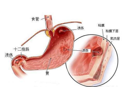 感觉肚子涨涨的怎么办