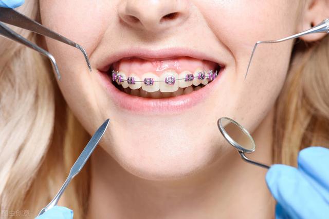 儿童牙齿矫正几岁开始好专家告诉你解决方案