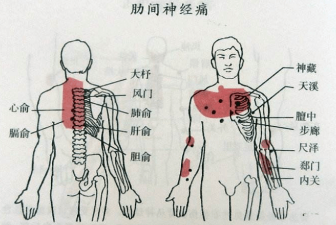 末梢神经炎你不知道的危害,只要记住一点便可控制?