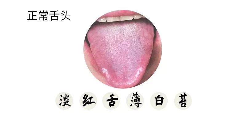 5种常见舌相学起来,出现第四种需要及时就医!