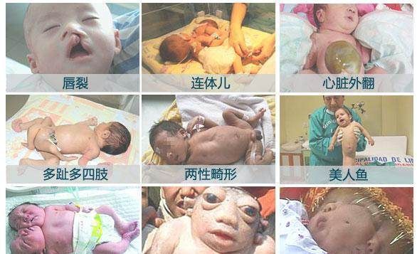 胎儿|胎儿畸形是怎样造成的?多数都与宝妈的行为有关