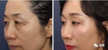 原创好歹也是娱乐圈第一代人造顶级美女,怎么也因为乱填充翻车了? 原创好歹也是娱乐圈第一代人造顶级美女,怎么也因为乱填充翻车了?