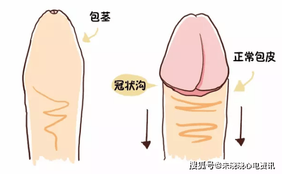 包皮可以不割，但撸不能停？居然是真的，扩散现在知道还不晚！