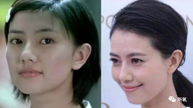原创好歹也是娱乐圈第一代人造顶级美女,怎么也因为乱填充翻车了? 原创好歹也是娱乐圈第一代人造顶级美女,怎么也因为乱填充翻车了?