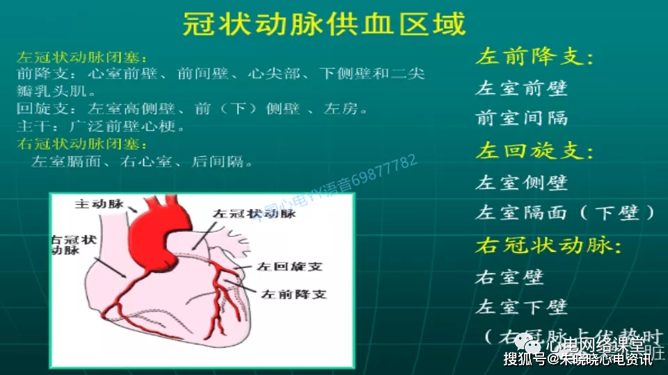 不典型心肌梗死的心电图改变