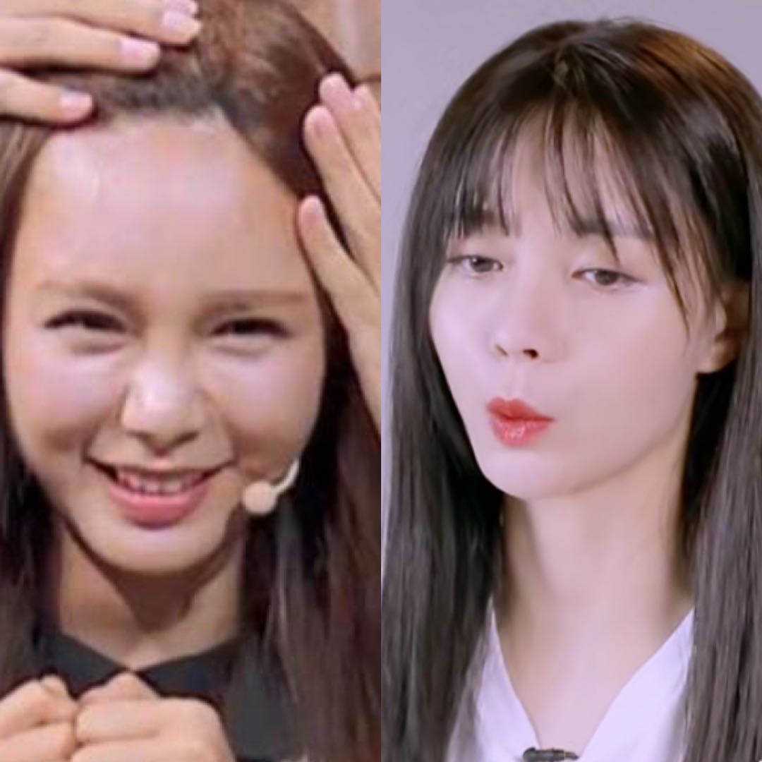 后移|鞠婧祎高发际线曝光,杨幂被质疑植发,她们二十多岁发际线堪忧