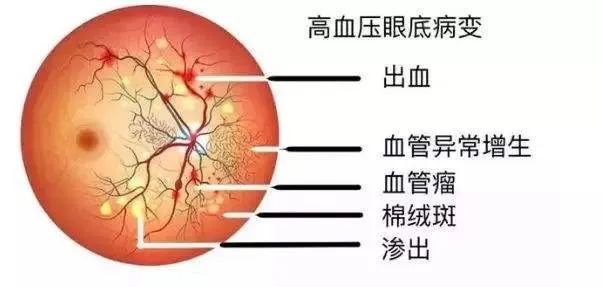 别只顾着自拍了,快来给眼底照个相吧!