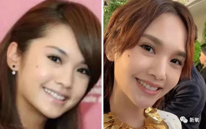 张脸|当年艳绝四方让张雨绮都甘心做配,可现在这张脸说崩就崩了...