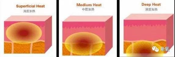 张脸|当年艳绝四方让张雨绮都甘心做配,可现在这张脸说崩就崩了...