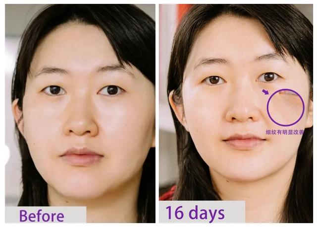 成分|爱了两年、空瓶N管！这些夏日舒爽小物，我真的离不开啊