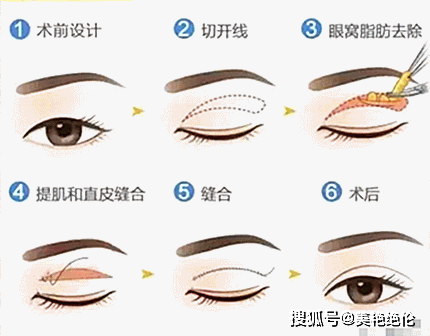 5239f723772f4688bcd809005c5e59cb.png