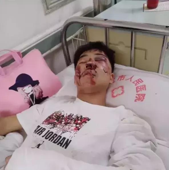 后仰跳投坠楼后续来了!小伙骨折+挫伤