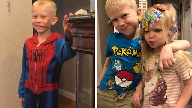 腰带|美国6岁男孩收到WBC荣誉金腰带，为救妹妹勇斗恶犬，泰森给他点赞