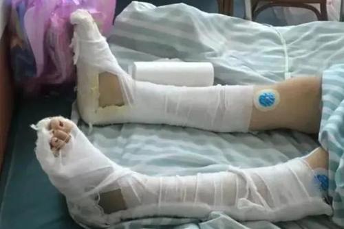 虐待|女子跳楼致截瘫：冷暴力、精神暴力、心理虐待，都是家暴的变种