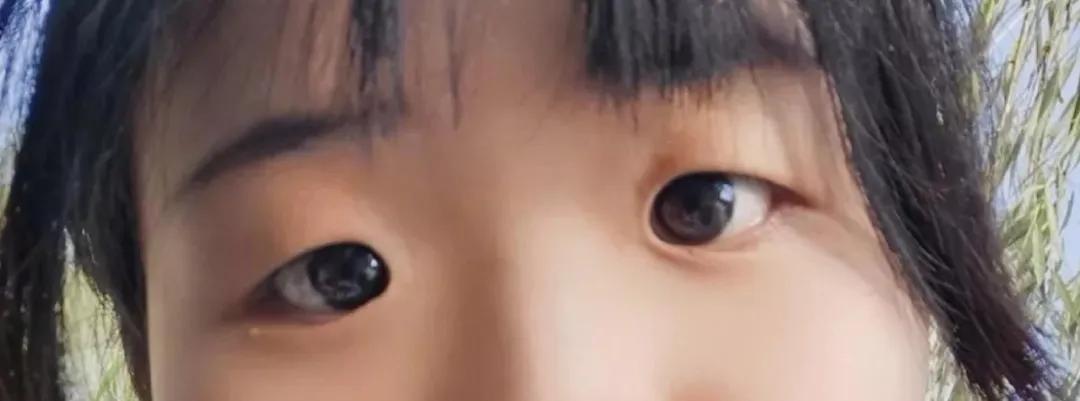 双眼皮|翻了100张照片，才发现她是贵圈换头最失败的女星