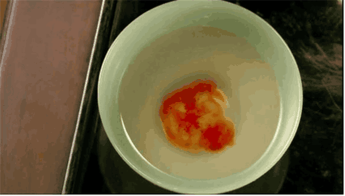 骨血|“滴血验亲”这事有科学依据吗