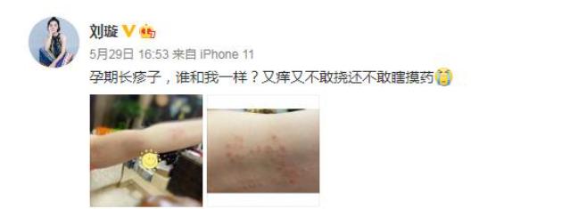 原创刘璇二胎不易！孕晚期身体肿胀不适，还挺孕肚坚持陪儿子练滑冰