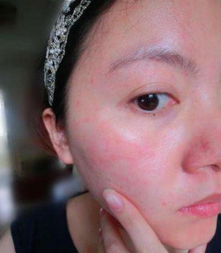 一用护肤品就过敏？真不该把原因赖在护肤品上，敏感肌修复有方法