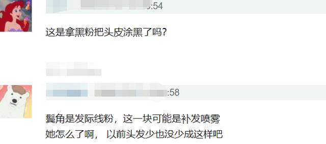 慎入|鞠婧祎再次暴露真实发量，痕迹明显密集恐惧症患者慎入