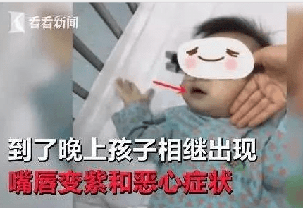 儿童上火有眼屎怎么办