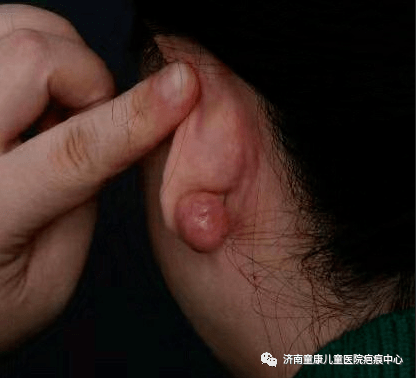 老年人口痒_重庆老年人口数据图