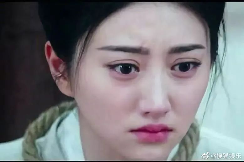 双眼皮|景甜整容整成了“悲伤蛙”，还有比这更悲伤的吗？