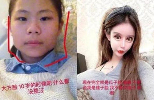 母亲|当年为整容花费百万，声称母亲支持的少女，如今容貌让人看了不适