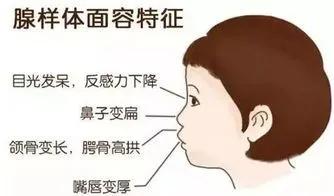 宝宝|这样做减轻孩子痛苦孩子睡觉有这个表现一定要注意！严重会影响智力发育